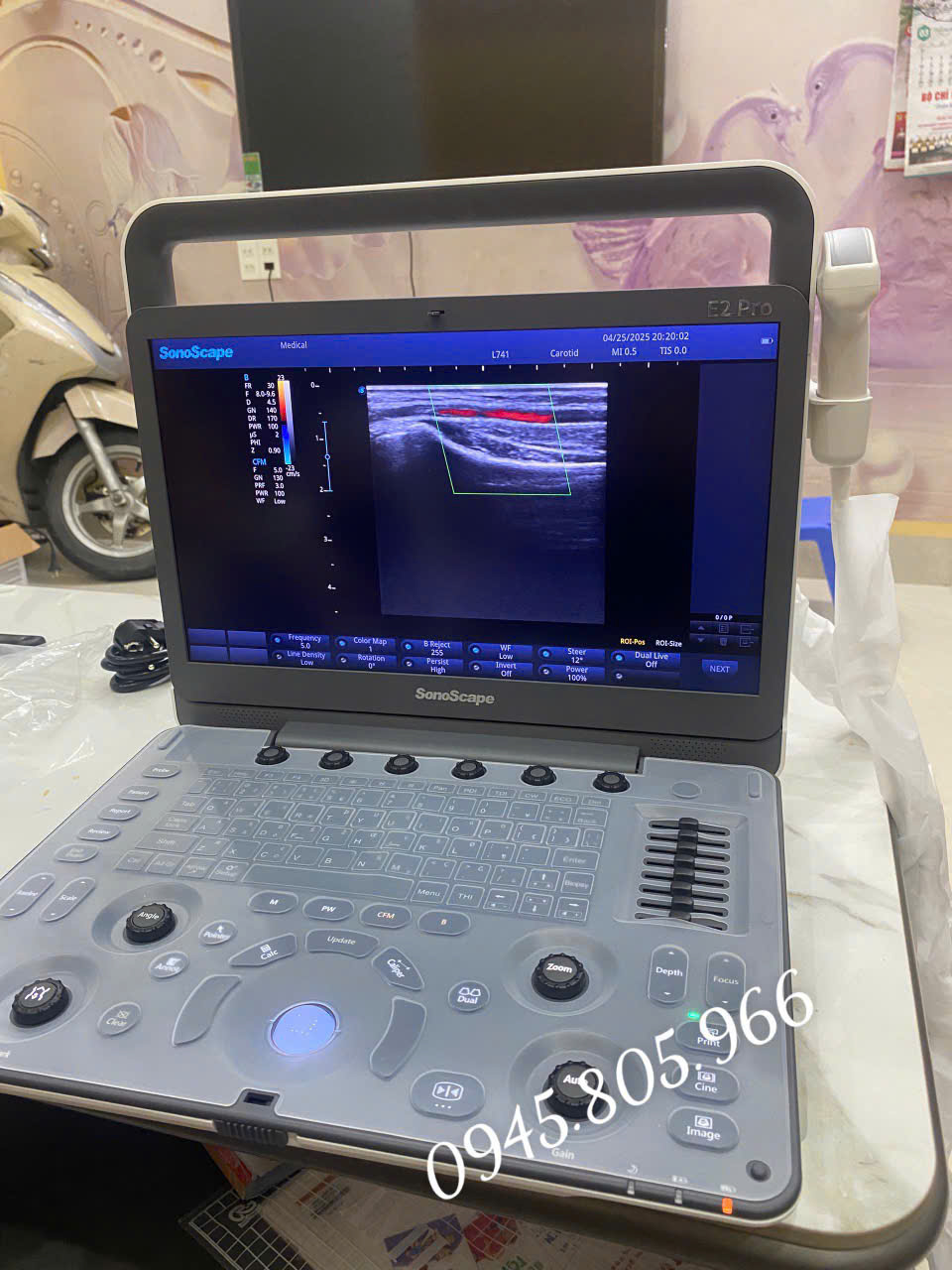 Máy siêu âm cơ xương khớp